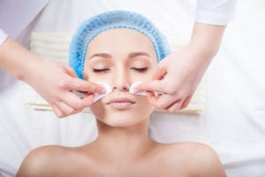 chemical-peels